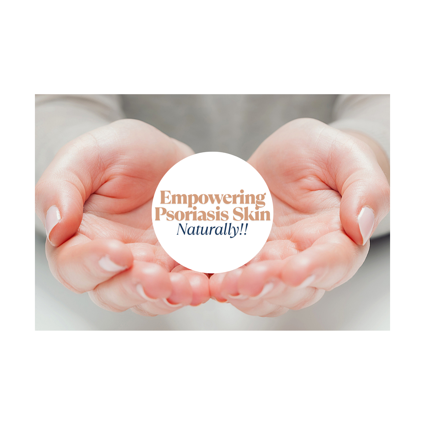 For Psoriasis - Calm. Soothe. Heal. LIVE!